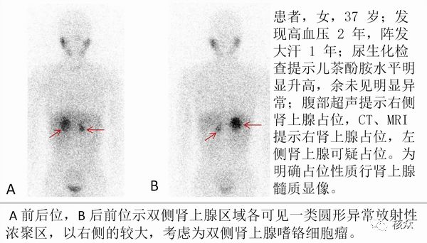 关于131检查的全过程解析,全面解析131检查过程,步骤、细节及应用